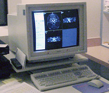 MRI computer monitor